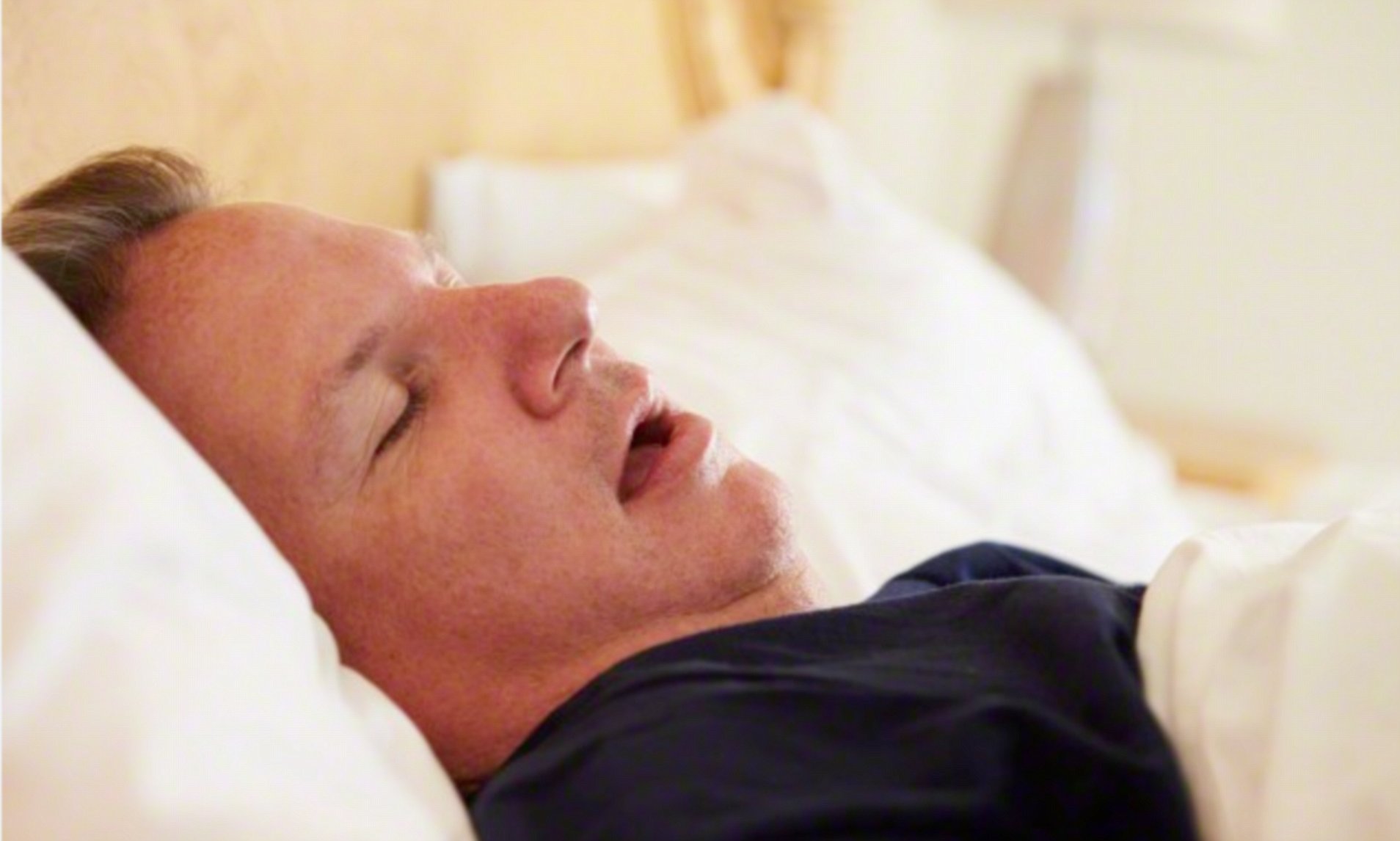 #sleep-apnea